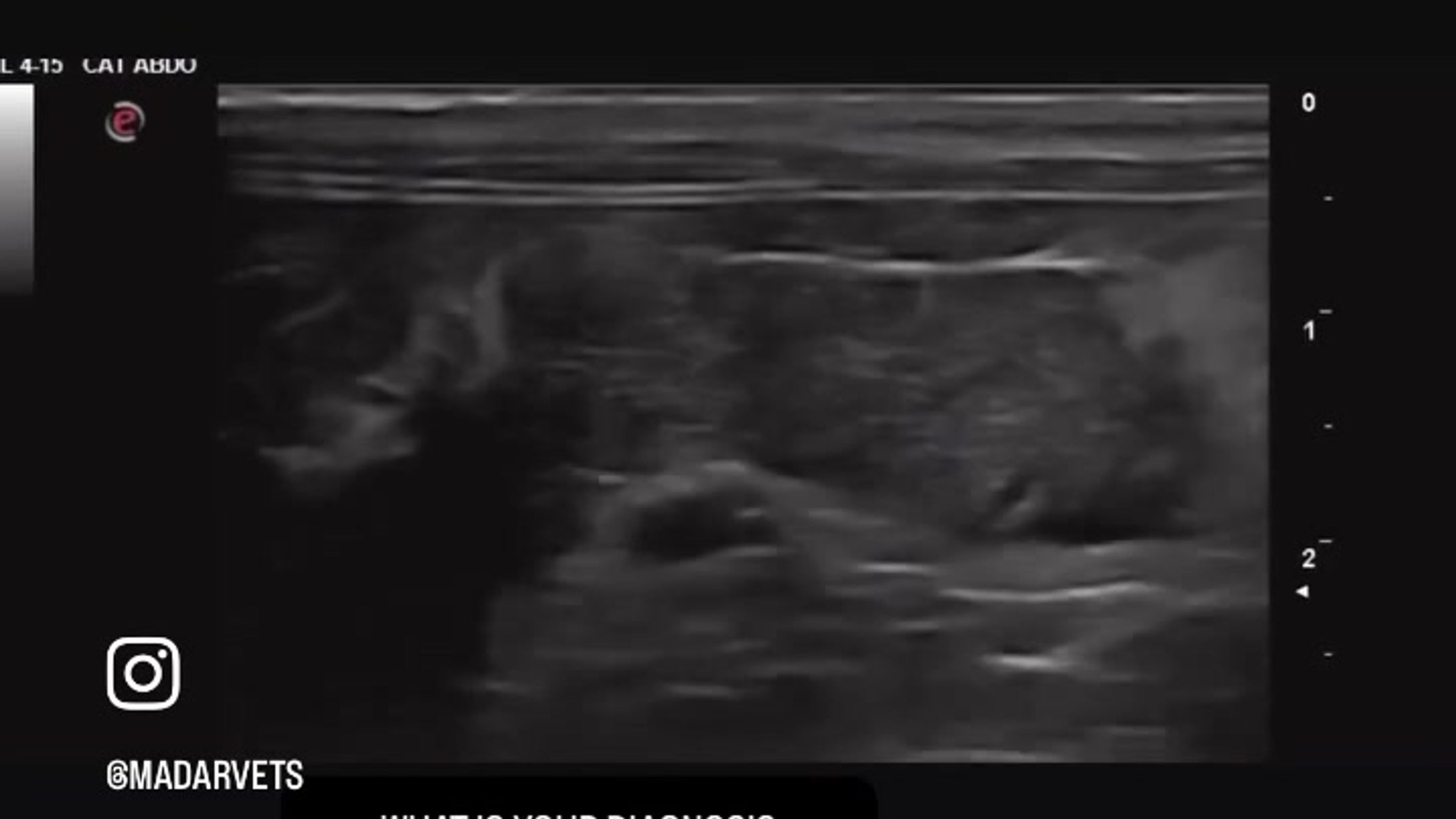 Ultrasounds
